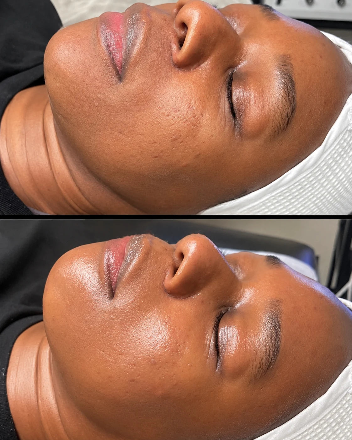 Before and after photo, Before / After