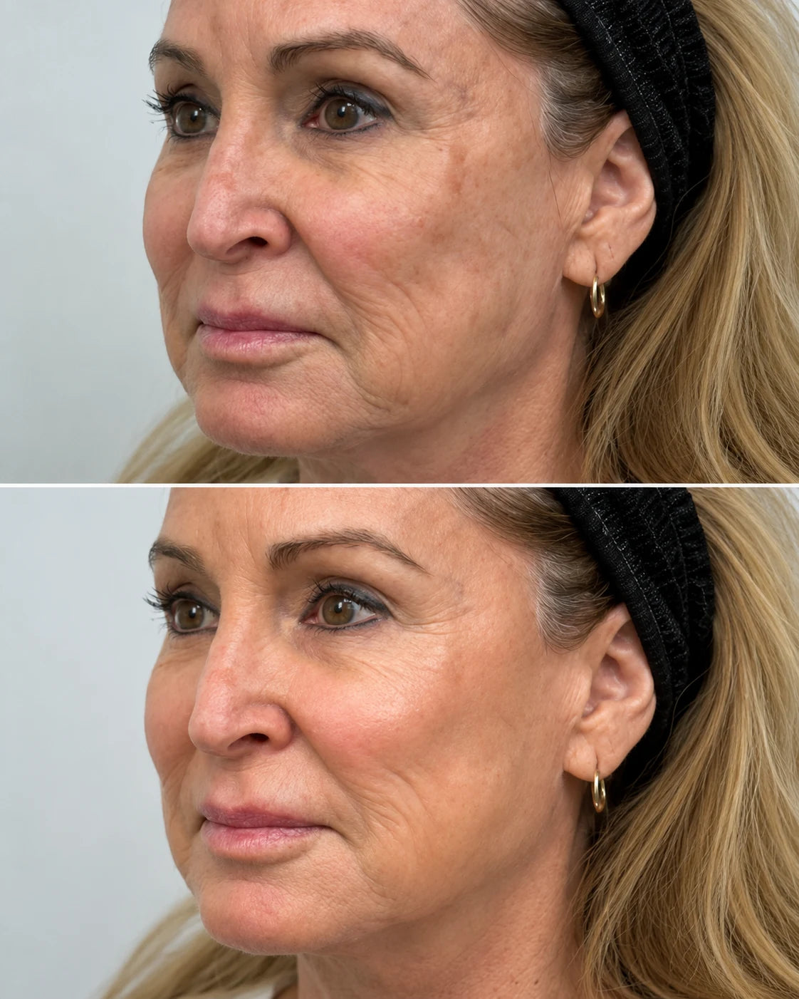 Before and after photo, Before / After