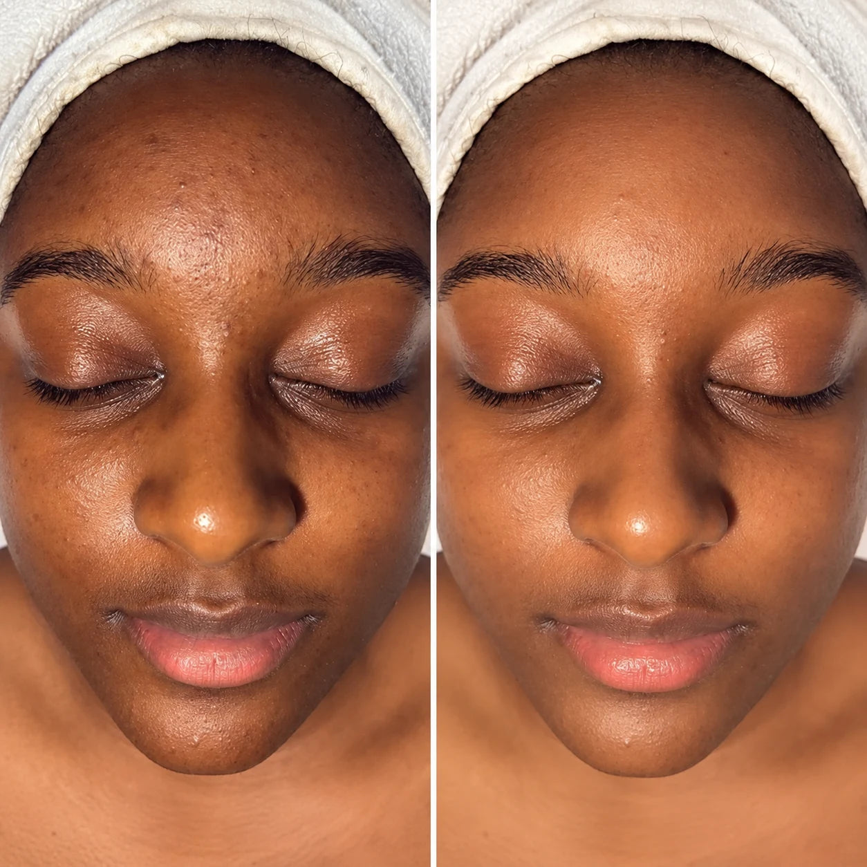 Before and after photo, Before / After
