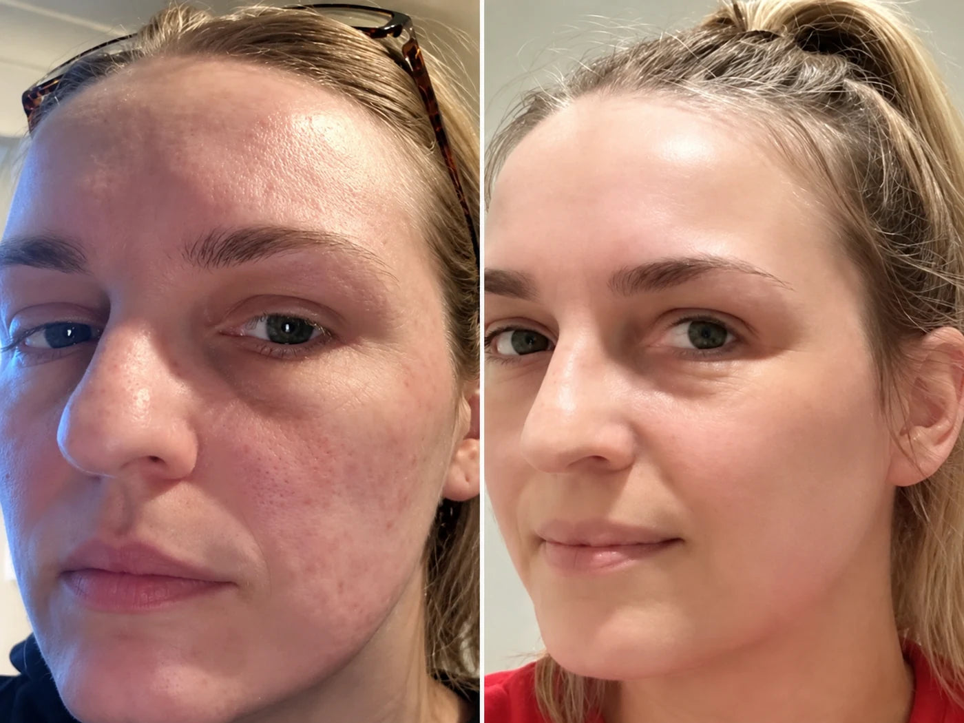 Before and after photo, Before / After