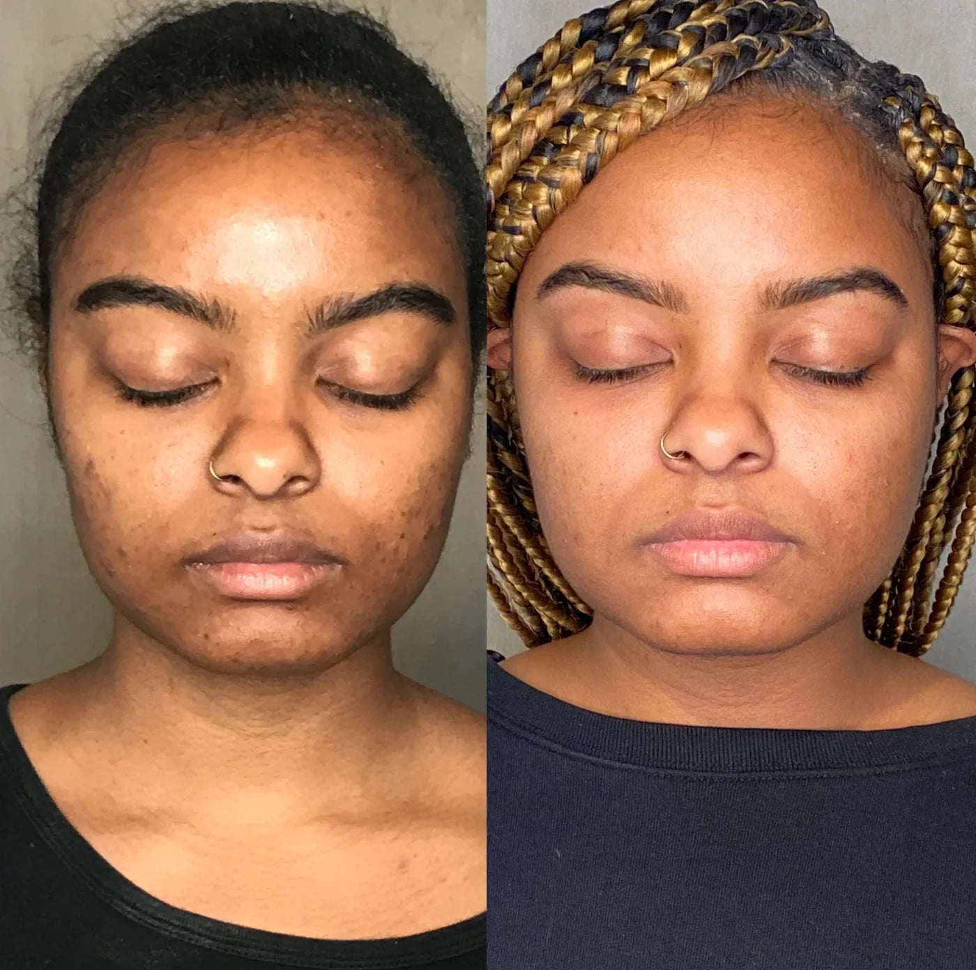 Before and after photo, Before / After