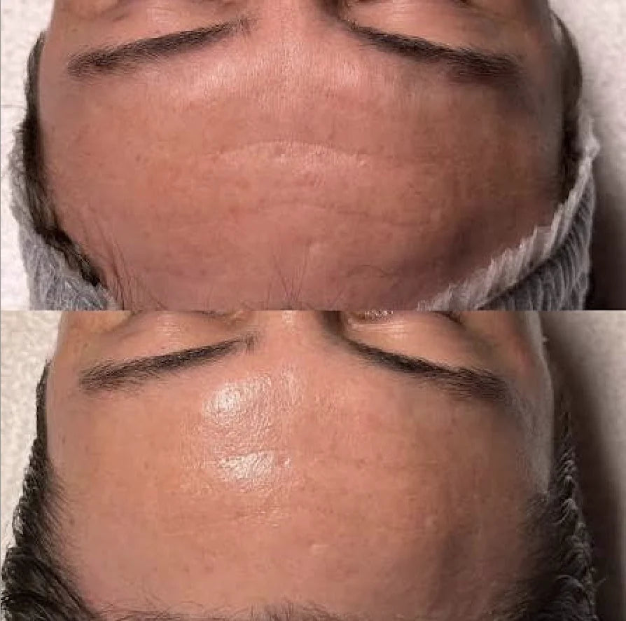 Before and after photo, Before / After