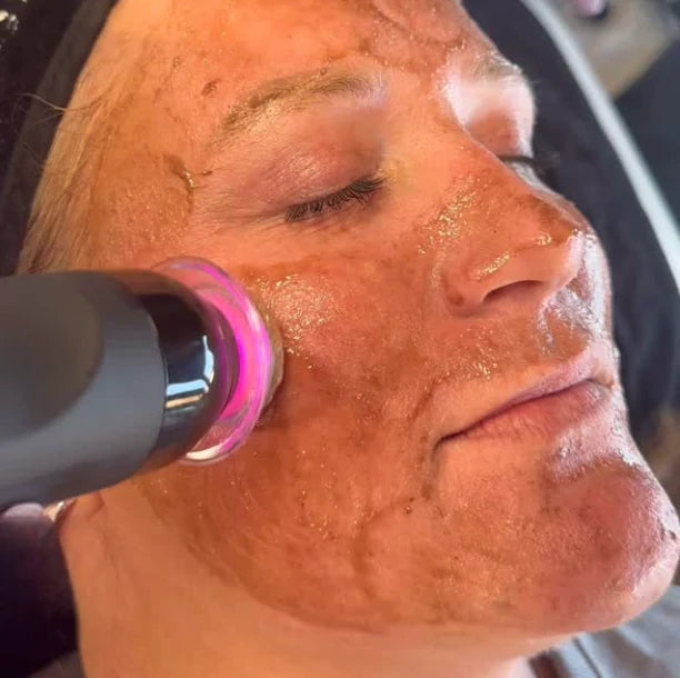 The pen gliding over a cheek through a treatment, pink light on